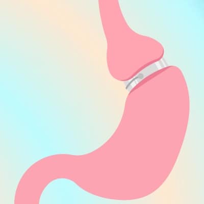 virtual gastric band hypnosis