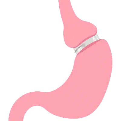 hypnosis virtual gastric band