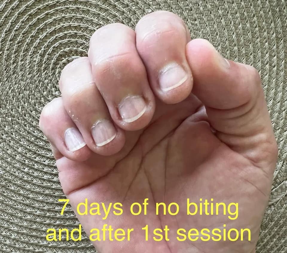 7 days after first hypnosis session